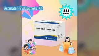Diagnóstico exacto del kit de prueba ELISA HSV-IgG