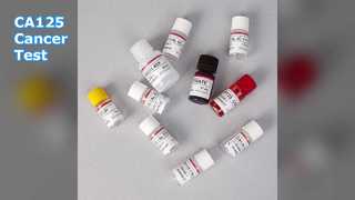 Prueba ELISA CA125 para el seguimiento del cáncer