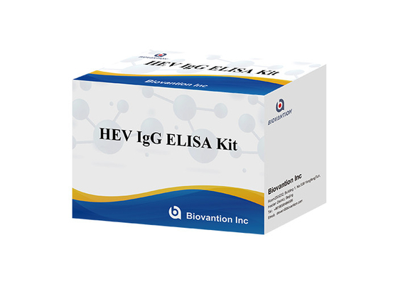 Anticuerpo humano de HEV Igg Elisa Kit Diagnostic For IgG al virus de la hepatitis E