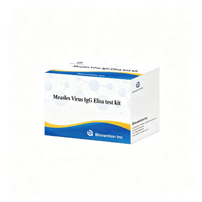 El virus del sarampión IgG ELISA Kit de prueba de alta sensibilidad