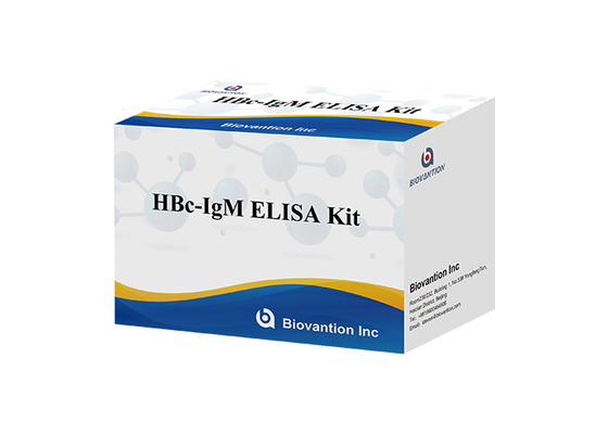 Prueba de Igm del anticuerpo de la base de Kit Hepatitis B de la prueba de ISO13485 HBc IgM