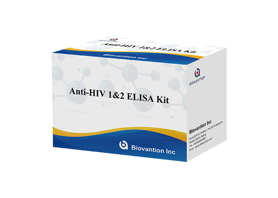 Para laboratorio o hospital Kit de prueba Elisa de alta precisión contra el VIH1/2