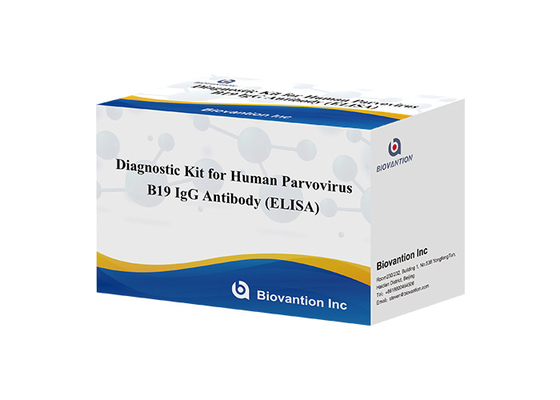 Kit de diagnóstico para el parvovirus humano B19 Kit de prueba IgG elisa Anticorpo para muestras de suero