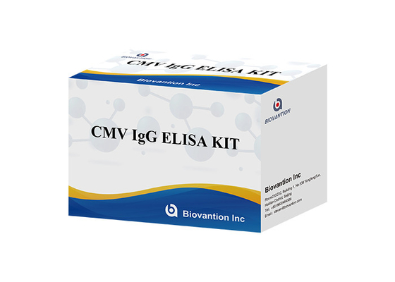 Kit de pruebas de alta precisión de laboratorio o hospital para pruebas de CMV IgG ELISA