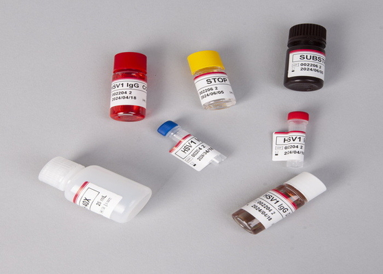 Para laboratorio o hospital, kit de ensayo Elisa de alta precisión CA15-3