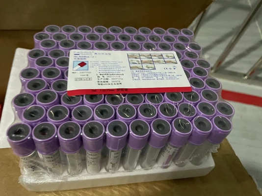 Kit de prueba ELISA IGRA fácil de tuberculosis con larga vida útil Método de conservación 2C-8C