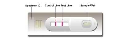 Autotest de laboratorio o hospital de alta precisión Leishmania Ab Combo Test Rápido