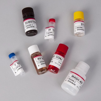 Kit de prueba RV-G Elisa para el diagnóstico del tipo de muestra de plasma