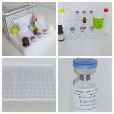 TB-IGRA en suero plasmático