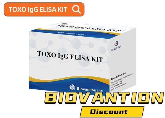 Kit de pruebas de Elisa sensible y específico de TOXO Ig G para el seguimiento de enfermedades