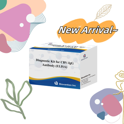 Kit de diagnóstico de sensibilidad para detección de anticuerpos humanos de CBV-IgG Kit Elisa para detección precisa del tipo de muestra