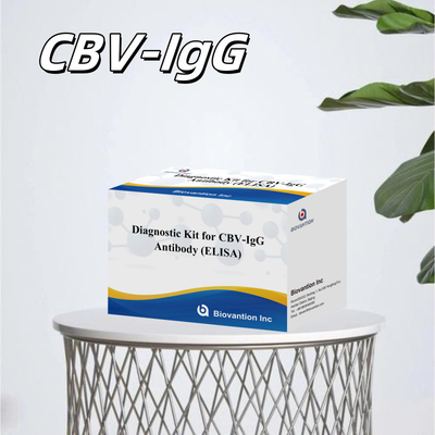 Kit de diagnóstico de sensibilidad para detección de anticuerpos humanos de CBV-IgG Kit Elisa para detección precisa del tipo de muestra