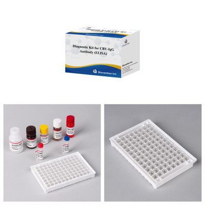 Kit de diagnóstico de sensibilidad para detección de anticuerpos humanos de CBV-IgG Kit Elisa para detección precisa del tipo de muestra