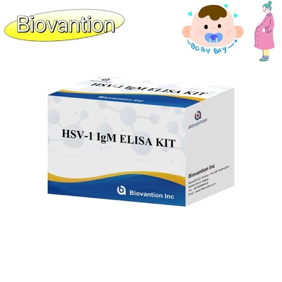 Kit de pruebas de ELISA con antorcha HSV 1 IgM Reactivo de diagnóstico de alta venta a fuego IVD