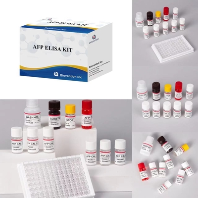 AFP Kit de prueba de alfa-fetoproteína Elisa Productos vinculados a las enzimas Tiempo de transporte corto
