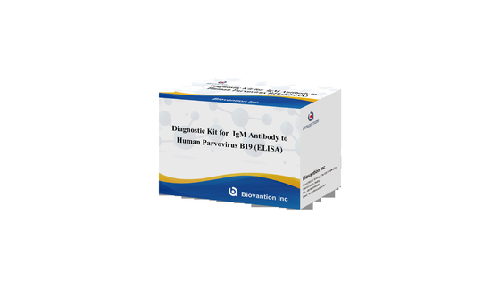 Kit de diagnóstico para el parvovirus humano B19 Kit de prueba IgG elisa Anticorpo para muestras de suero