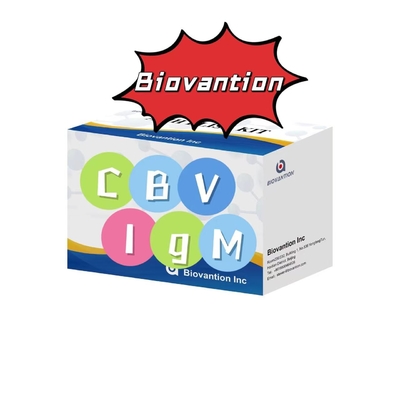 Kit de diagnóstico para anticuerpos IgM contra el VCB Kit de prueba Elisa 50μL Sero Diagnóstico médico