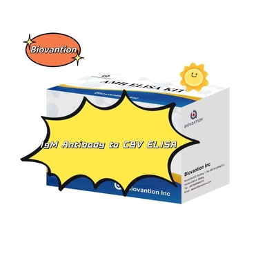 Kit de diagnóstico para anticuerpos IgM contra el VCB Kit de prueba Elisa 50μL Sero Diagnóstico médico