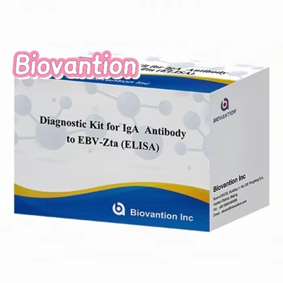 Kit de diagnóstico de anticuerpos IgA contra el EBV-Zta ELISA KIT de prueba de inmunosorbente