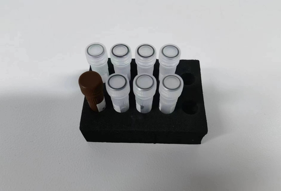 Hepatitis B Virus HBV Kit de PCR cuantitativo Sensibilidad de muestra Tipo de prueba Kit con 96 pruebas
