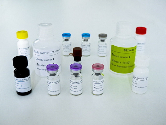 Kit de ensayo ELISA IGRA fácil de transmitir con larga vida útil y método de conservación 2C-8C