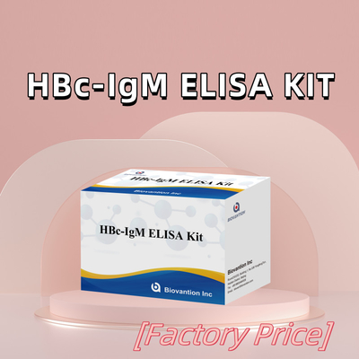 Prueba con reactivo de diagnóstico de antígeno IgM HBc de alta precisión con kit de prueba de inmunosorbente ligado a enzimas
