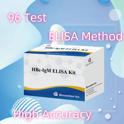 Prueba con reactivo de diagnóstico de antígeno IgM HBc de alta precisión con kit de prueba de inmunosorbente ligado a enzimas