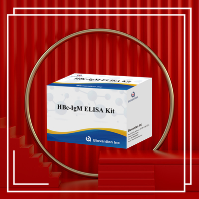 Prueba con reactivo de diagnóstico de antígeno IgM HBc de alta precisión con kit de prueba de inmunosorbente ligado a enzimas