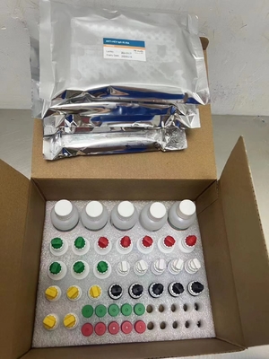 Nuevo reagente IVD de llegada HCV prueba de reagente de diagnóstico para el laboratorio clínico de hospital humano