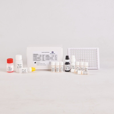 Para el laboratorio o el hospital Kit de prueba Elisa de alta precisión H.Pylori IgG