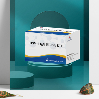 Kit de prueba de inmunoensayo de alta sensibilidad para el HSV-1 IgG para detección serológica Tipo de muestra de plasma