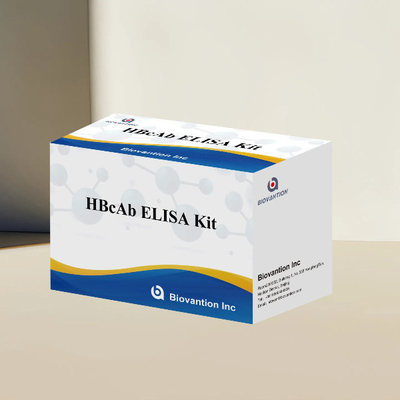Kit de análisis de HBcAb ELISA y Kit de detección de anticuerpos