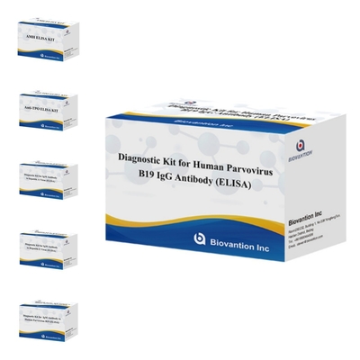 Kit de prueba de ELISA B19 para el parvovirus humano B19 IgM Kit de prueba de anticuerpos Elisa con 96T