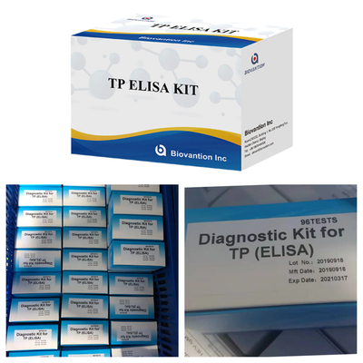 Prueba de ELISA de venta caliente Anticorpos de sífilis Kit de prueba de inmunología vinculada a enzimas Elisa
