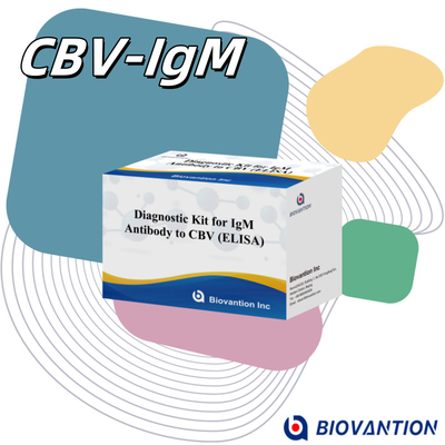 Reactivo de diagnóstico para el igm de CBV ELISA KIT D 18 meses Tiempo de conservación Prueba de ensayo inmunosorbente ligada a enzimas