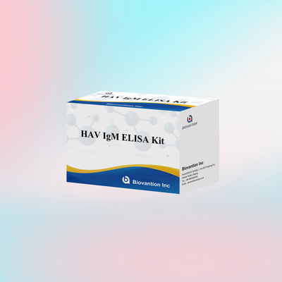 HAV IgM ELISA Kit Alta sensibilidad Hepatitis A Detección de virus Prueba de diagnóstico precisa y confiable para laboratorios clínicos