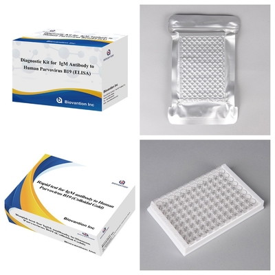 Kit avanzado de prueba de ELISA de anticuerpos IgM para el parvovirus humano B19 para la detección y detección del embarazo