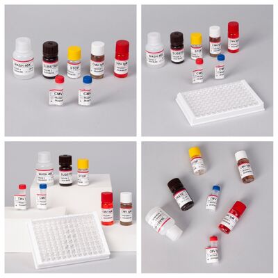 Kit de ensayo 96T CMV ELISA con detección colorimétrica y método sandwich para anticuerpos contra el citomegalovirus