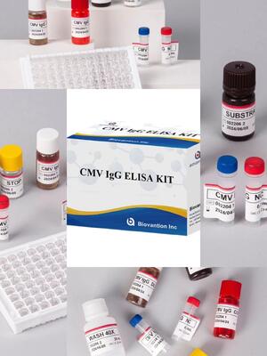 Kit de prueba de alta precisión de CMV IgG Elisa para laboratorio o hospital