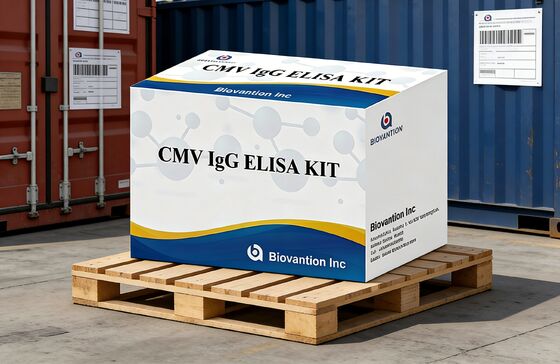 Kit de prueba de alta precisión de CMV IgG Elisa para laboratorio o hospital