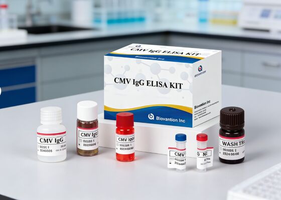 Kit de prueba de alta precisión de CMV IgG Elisa para laboratorio o hospital