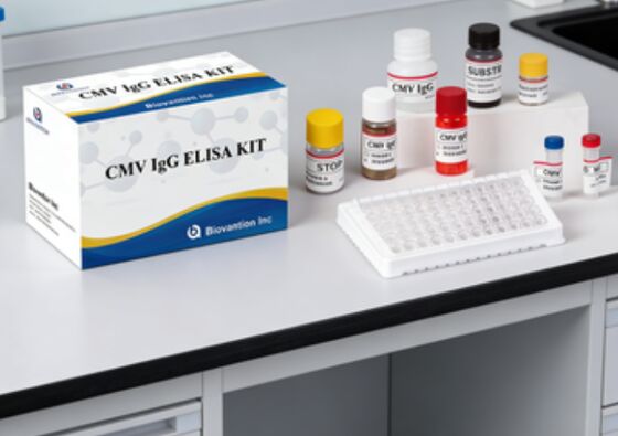 Kit de prueba de alta precisión de CMV IgG Elisa para laboratorio o hospital