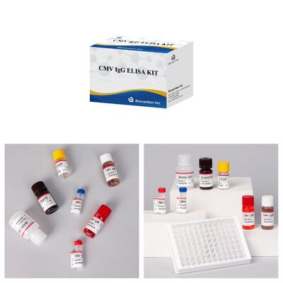 Reactivos de análisis inmunológico de enzimas Kit de prueba Elisa para la detección de anticuerpos CMV del citomegalovirus